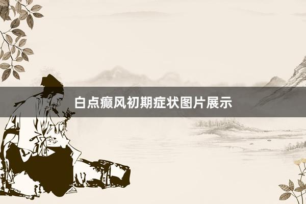 白点癫风初期症状图片展示